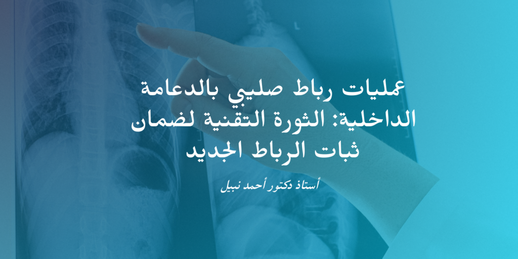 عمليات رباط صليبي بالدعامة الداخلية