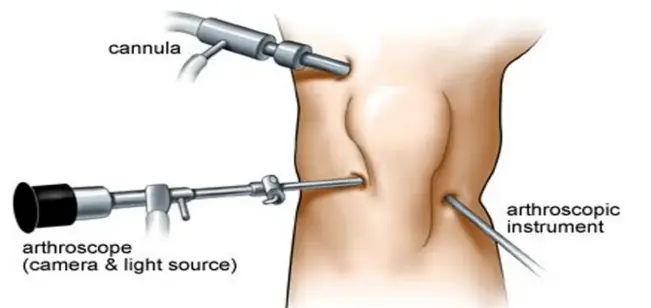 ad 4nxcmezt tkl2sess5zq1tbu06b32