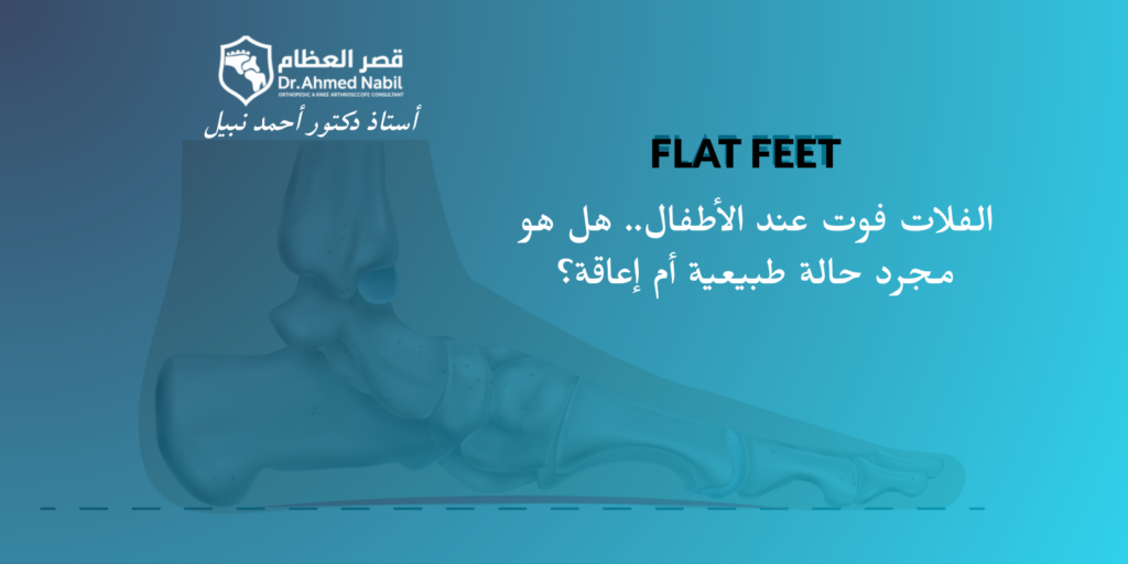 الفلات فوت عند الأطفال