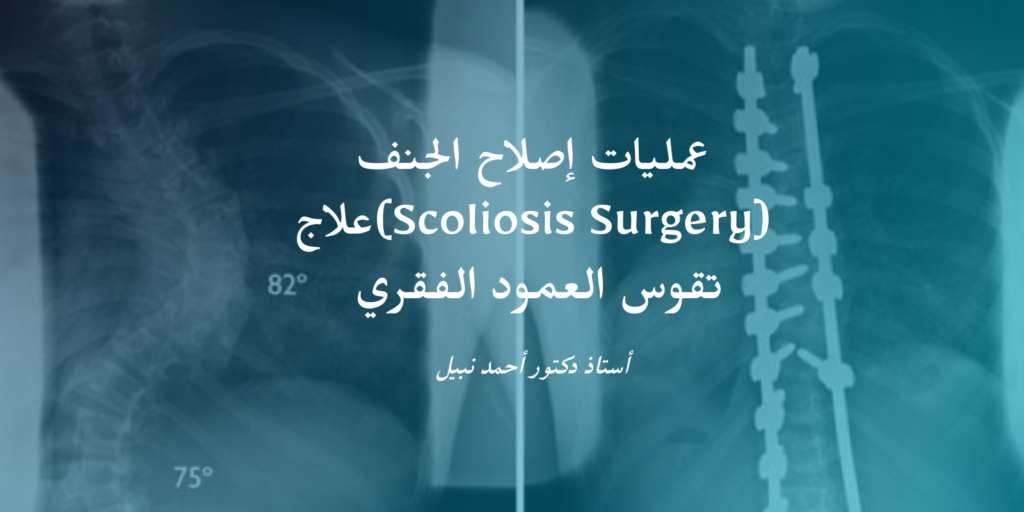 علاج تقوس العمود الفقري