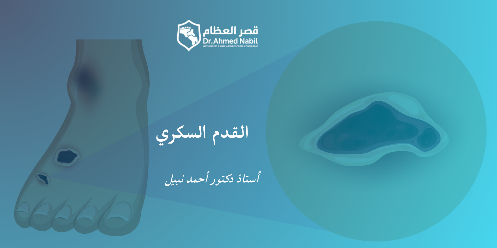 القدم السكري