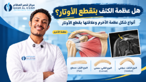 arabic orthopedic shoulder anatomy infographic