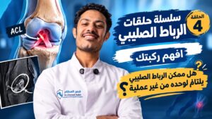 قطع الرباط الصليبي